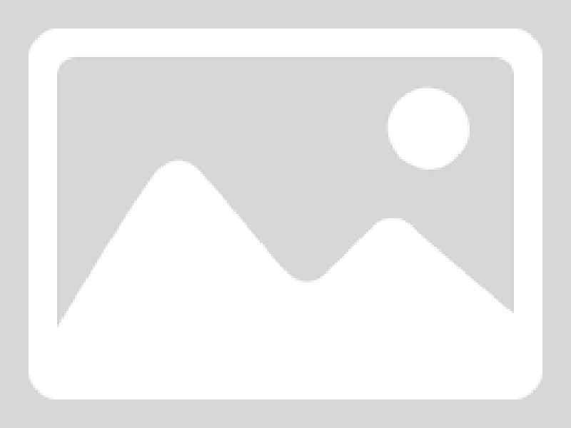 电解质分析仪